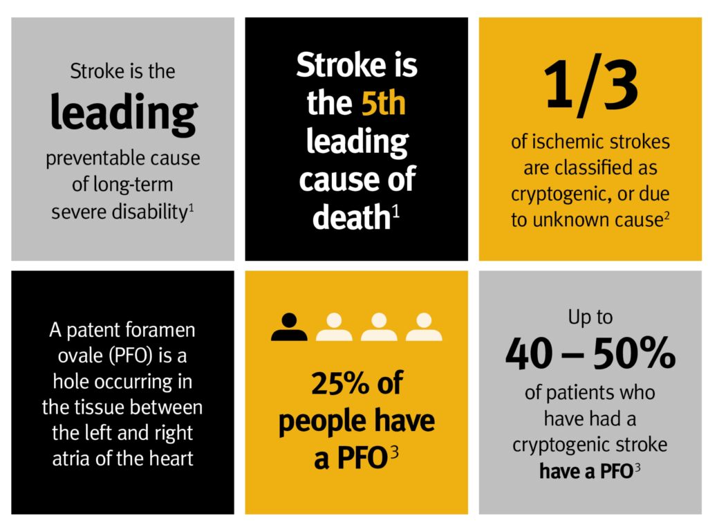 Stroke Statistical Graphic